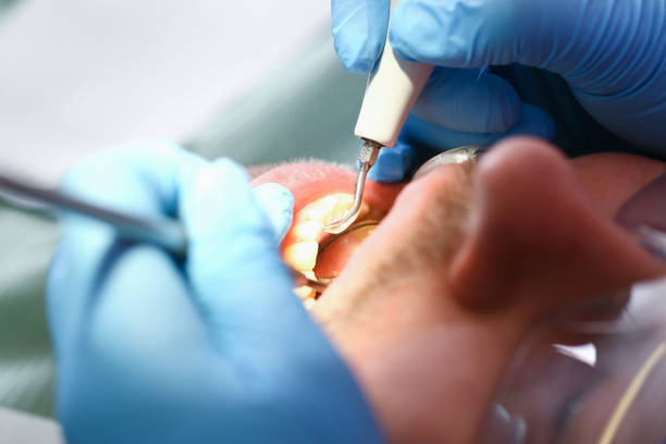 Best Emergency Denture Repair in Secy, AR