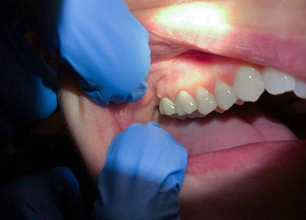 Best Emergency Denture Repair in Secy, AR