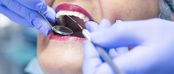 Best Emergency Wisdom Teeth Removal in Secy, AR